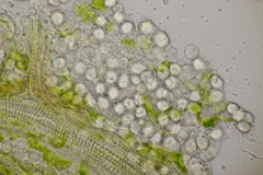 Entyloma ranunculorum