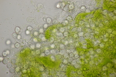 Entyloma ranunculorum