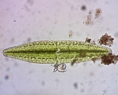 Netrium digitus