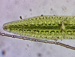 Netrium digitus