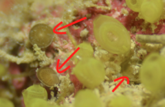 Amphistegina