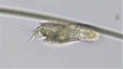 Cephalodella gracilis