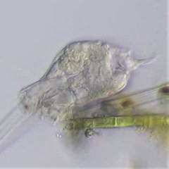 Cephalodella gracilis