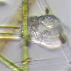 Cephalodella gracilis