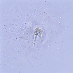 Cephalodella gracilis