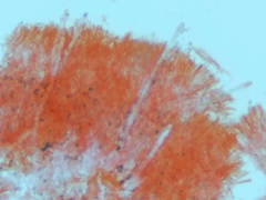 Dacryobolus karstenii