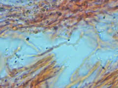 Dacryobolus karstenii