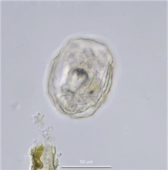 Lecane closterocerca