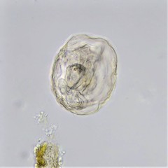 Lecane closterocerca