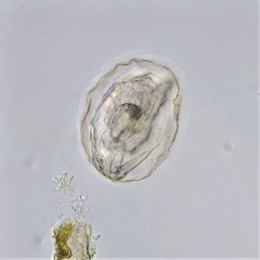 Lecane closterocerca