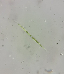 Closterium acutum