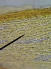 Ptychostomum imbricatulum