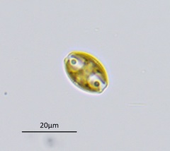 Amphora ovalis