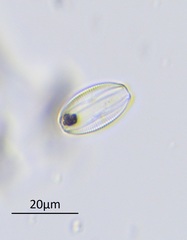 Amphora ovalis