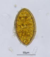 Surirella undulata