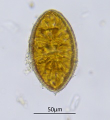 Surirella undulata