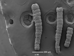 Scherochorella moniliformis