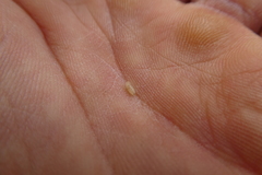 Phytomyza abdominalis