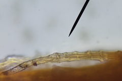 Orthotrichum anomalum