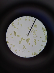 Orthotrichum anomalum