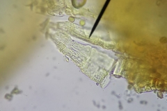 Orthotrichum anomalum