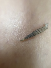 Brachypodella speluncae