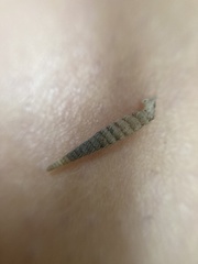 Brachypodella speluncae