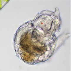 Philodina megalotrocha