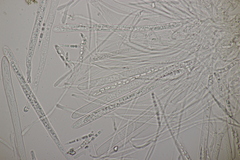 Godronia ribis
