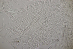 Godronia ribis