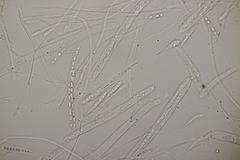 Godronia ribis