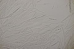 Godronia ribis