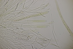 Godronia ribis