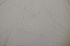 Godronia ribis