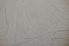 Godronia ribis