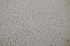 Godronia ribis