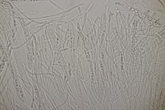 Godronia ribis