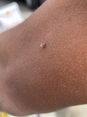 Tropidosteptes quercicola
