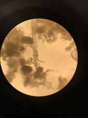 Gastrotricha