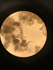 Gastrotricha