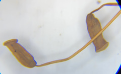 Polytrichum pallidisetum