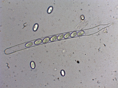 Scutellinia erinaceus
