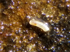 Caecum