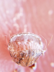 Allokermes cueroensis