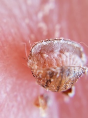 Allokermes cueroensis