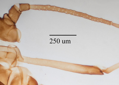 Hyperomyzus lactucae