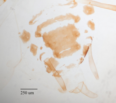 Hyperomyzus lactucae