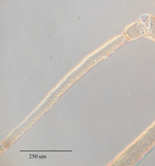 Hyperomyzus lactucae