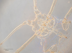 Hyperomyzus lactucae