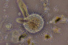 Actinosphaerium eichhornii